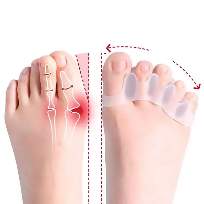 Soft Silicone Toe Separator & Foot Corrector
